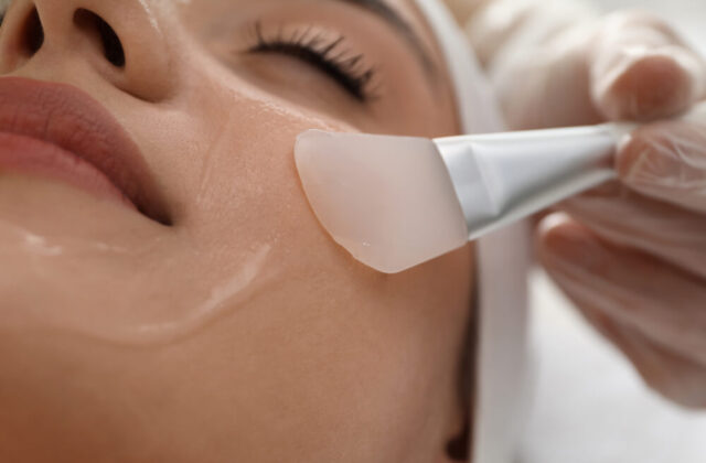 peeling chemiczny