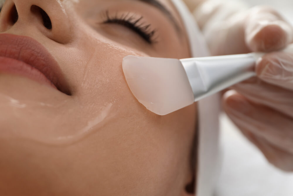 peeling chemiczny
